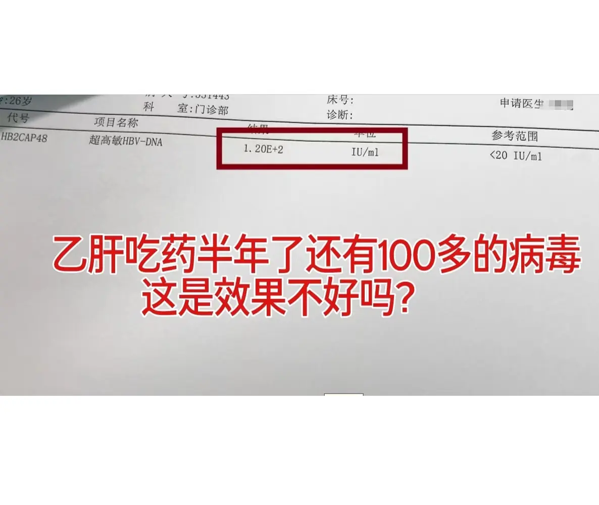 这是一位山东淄博的乙肝小伙的病毒量单子，他吃药大概有半年的时间了，吃的...