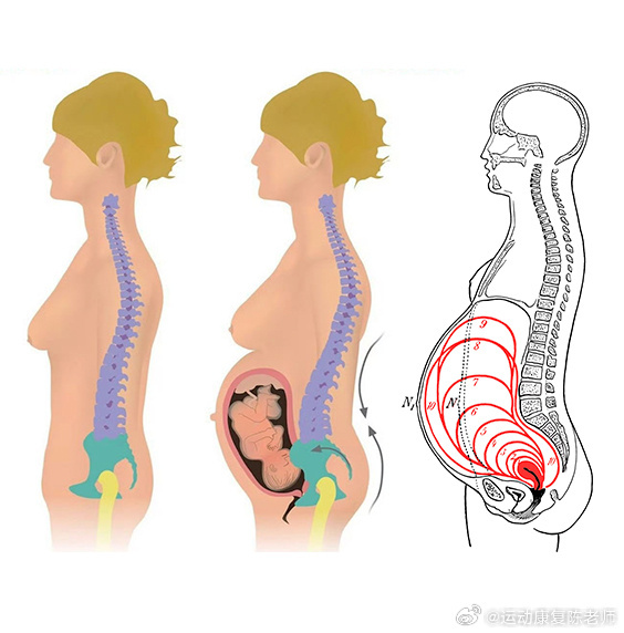 产后腰痛 来看这张图，你就知道怀孕时子宫的变化，和为什么怀孕的妈妈，会容易腰痛了