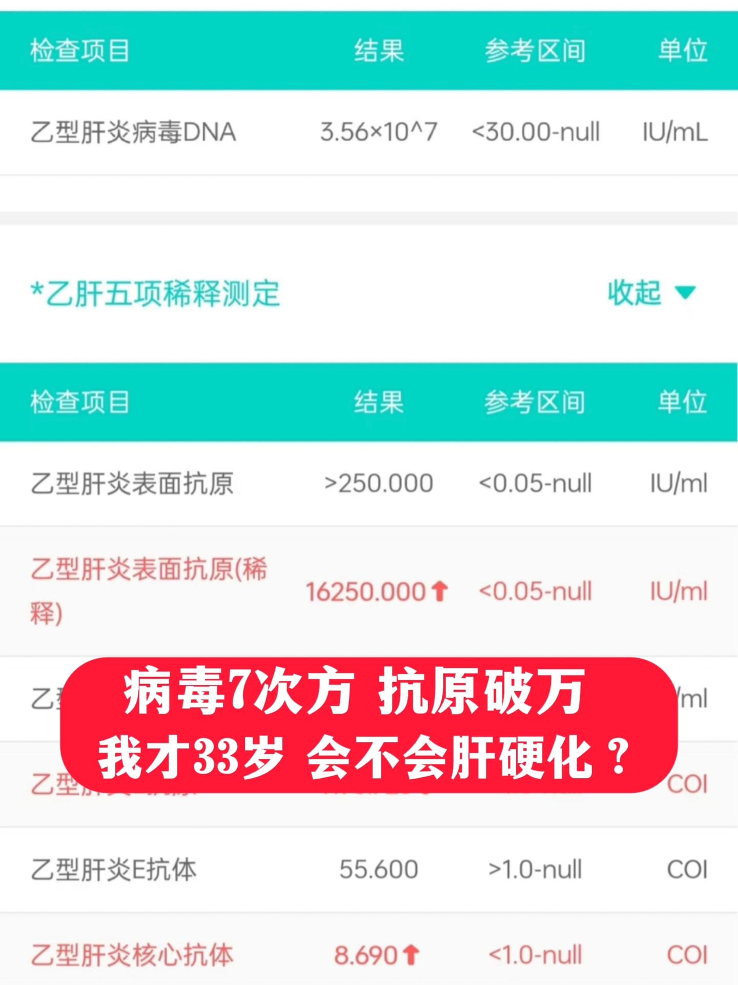 今天上午，门诊接诊了位33岁的乙肝男子，病毒7次方，表面抗原1万6，患...