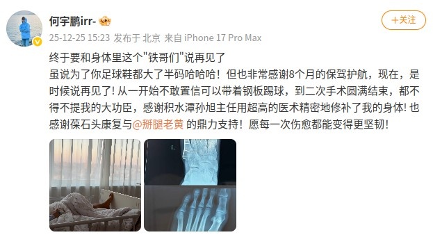 何宇鹏社媒晒摘除左足钢板照：终于和身体里这个“铁哥们”说再见