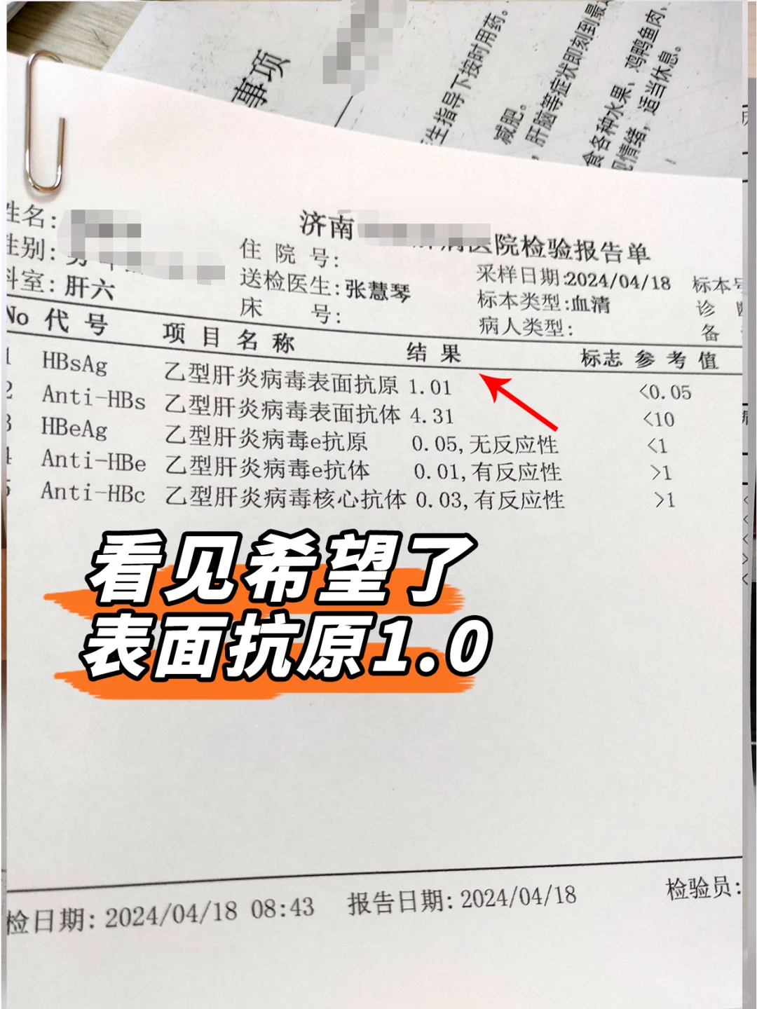 乙肝转阴看到希望了，表面抗原降到1.01→