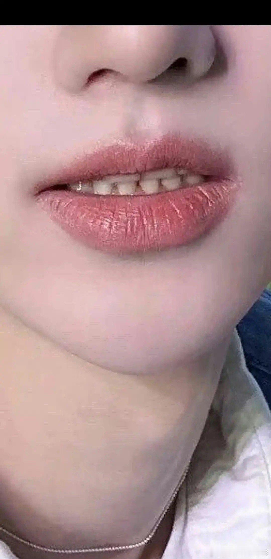 这个牙缝和牙齿，爱豆是不是不刷牙啊 ​​​