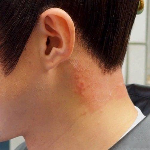 王鹤棣这是怎么了？戴头套过敏了