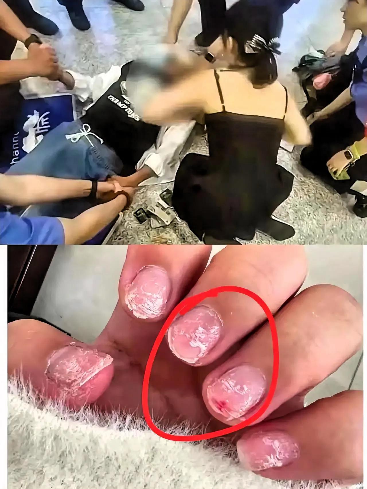 我老公之前还纳闷，急救病人不是本职吗，怎么李梦旖护士突然就刷屏了？直到我让他看自