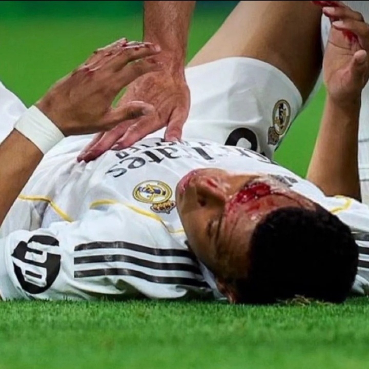 4月13日讯 据西班牙媒体《阿斯报》报道，姆巴佩将首发出战拜仁，但不会佩戴防护面