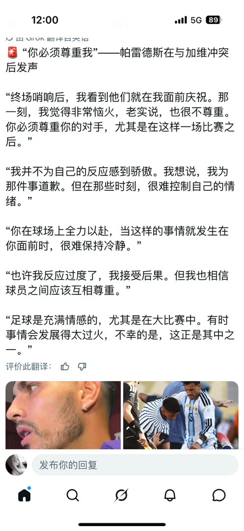 没脸没皮的混蛋有什么资格谈不尊重 怎么不说说那天怎么对我们英格兰的 肮脏的球员只
