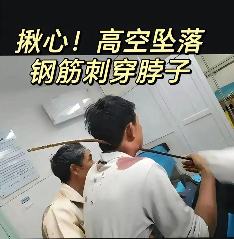 工地事故有一种疼叫做看着都疼