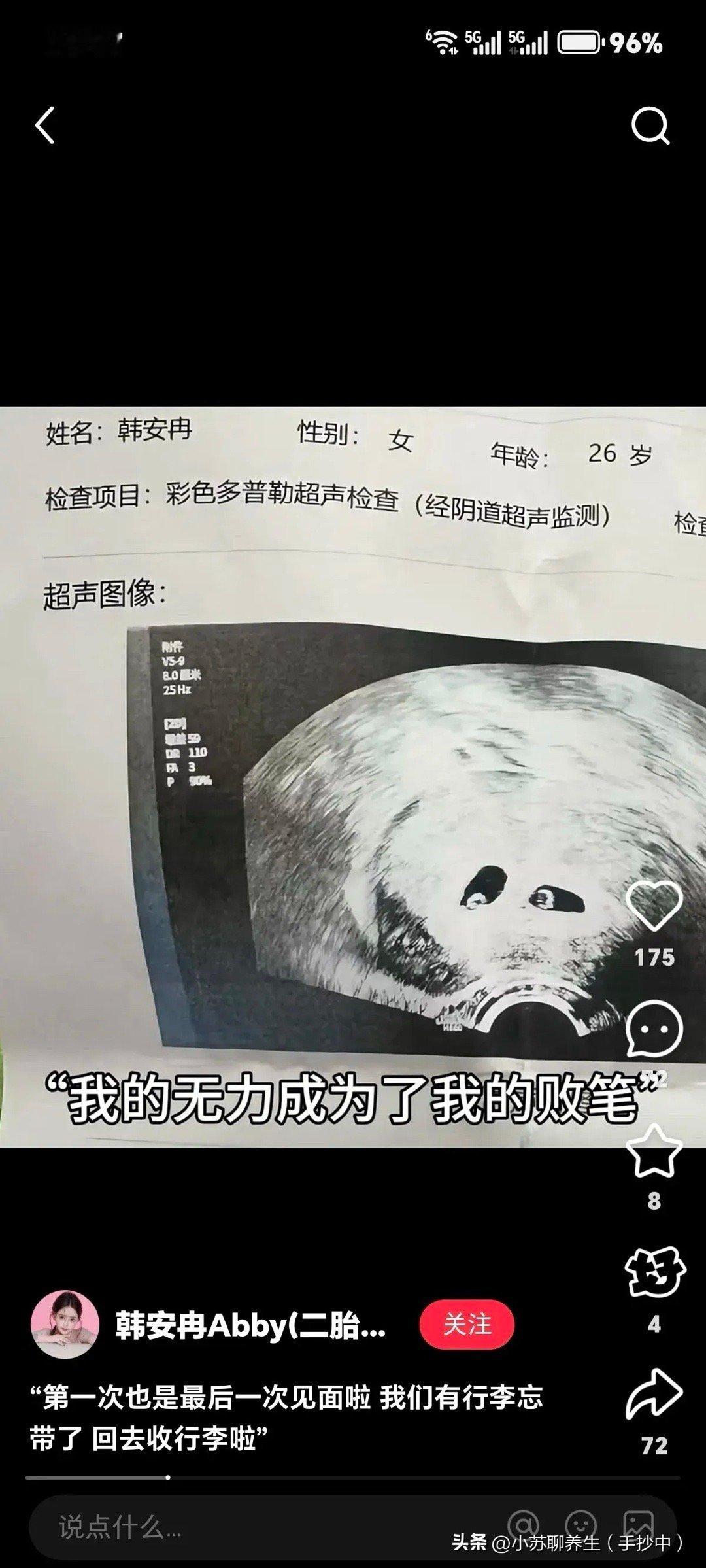 曝韩安冉流产韩安冉双胞胎流了？这也太突然了，昨天看到还觉得运气挺好又是双胞胎，那
