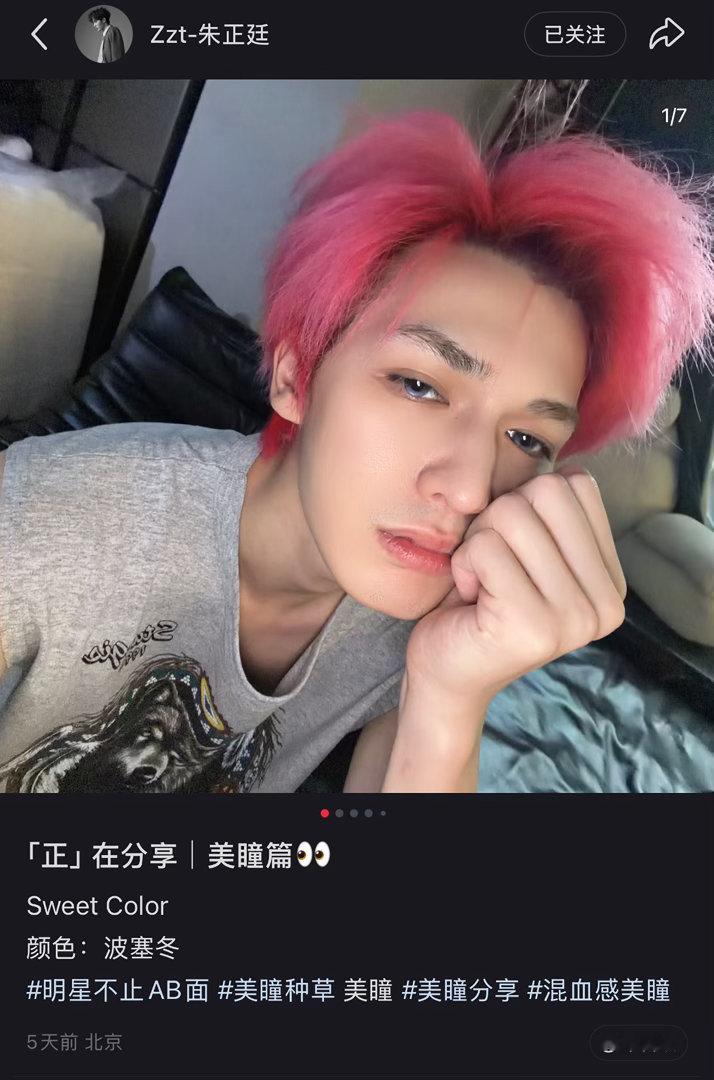 这个牌子的定轴好戴吗各位！有的定轴我戴着磨眼睛🥺这个花色挺好看的看起来着色直径