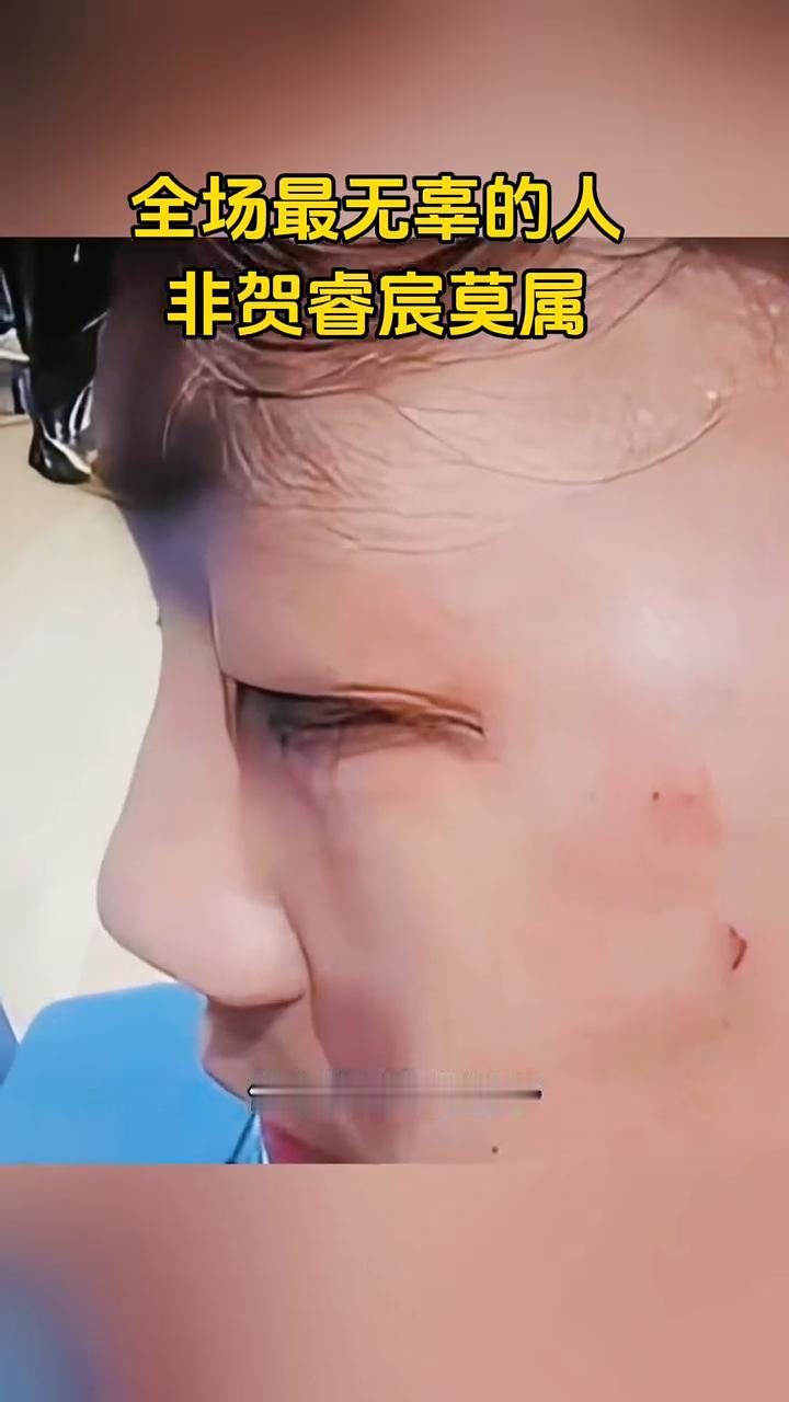 全场最无辜的人非贺睿宸莫属。
全场最无辜的人非贺睿宸莫属。规规矩矩比赛，拼硬实力