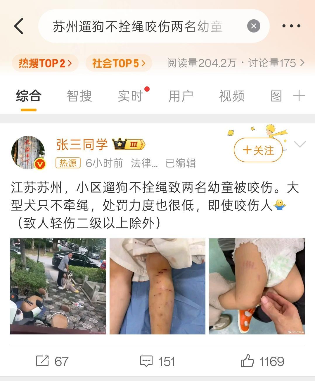 苏州遛狗不拴绳咬伤两名幼童这类案子，基本上就是个民事赔偿。除非狗把人咬成重伤或者