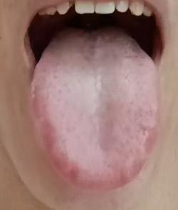 肾阳亏虚周身畏寒，温阳固肾补足一身元气







一位年过四十的粉丝留言倾诉