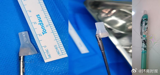 【9岁#男童将笔帽吸入肺中7小时险丧命#】近日，一名9岁男童一名从当地医院紧急转