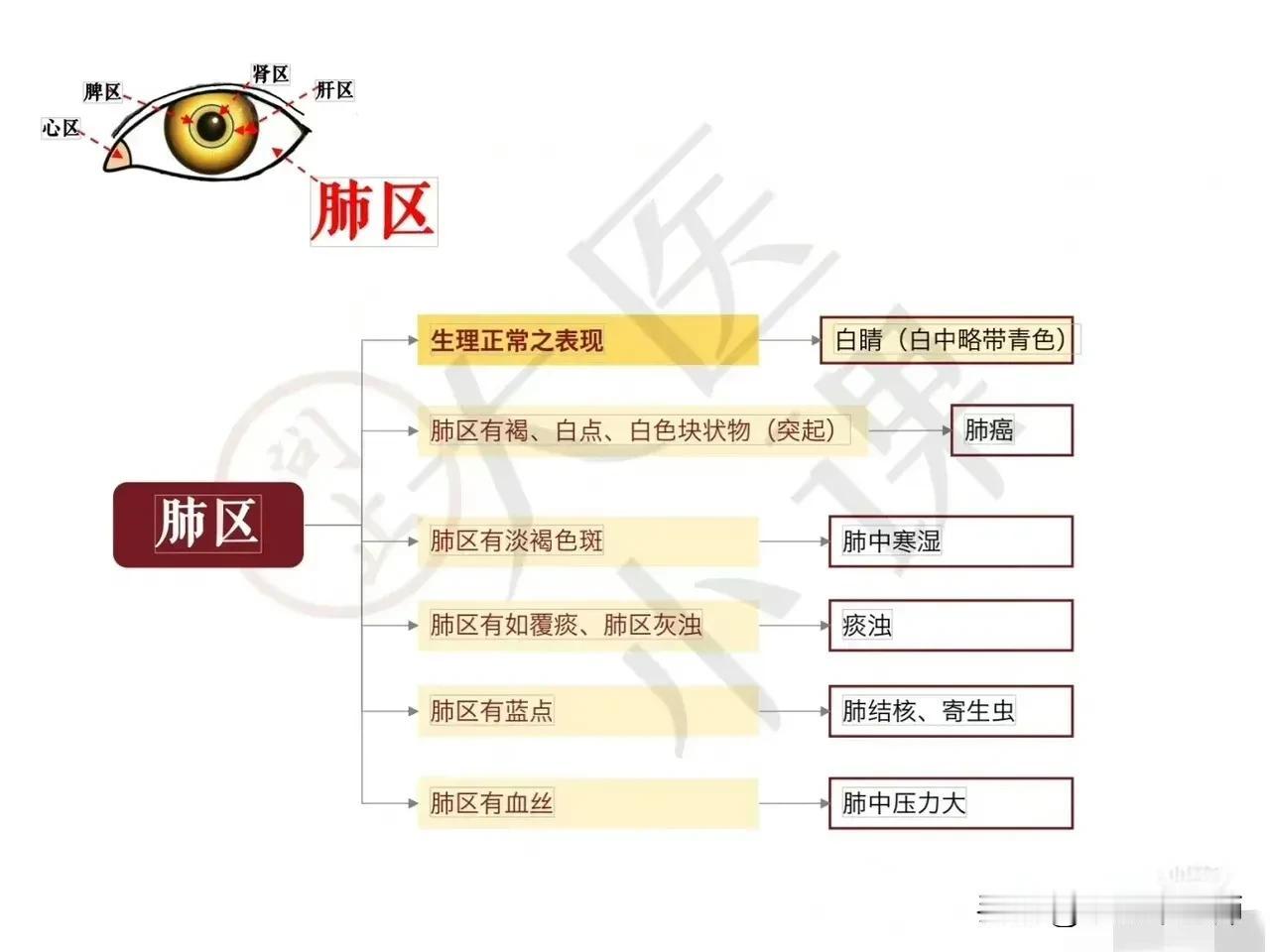 倪海厦先生的眼诊法，图片更一目了然。
眼睛里眼角代表心，眼白是肺，无论什么人种瞳