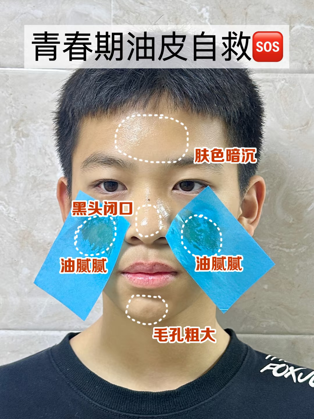 鲨疯了❗青春期爆油的秒冲就对了❗