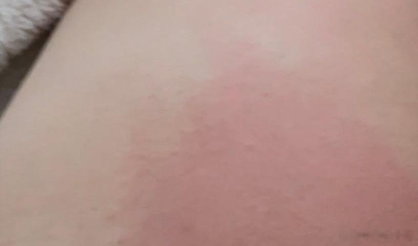 谁赖床呢？陪我挨巴掌！！！#巴掌印[超话]# ​​​