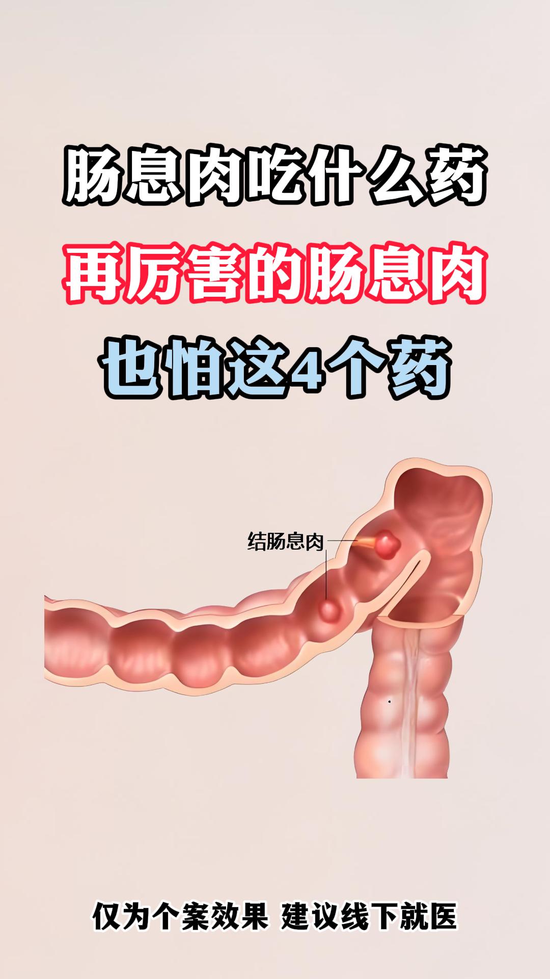 再厉害的肠息肉，都害怕这4个中成药