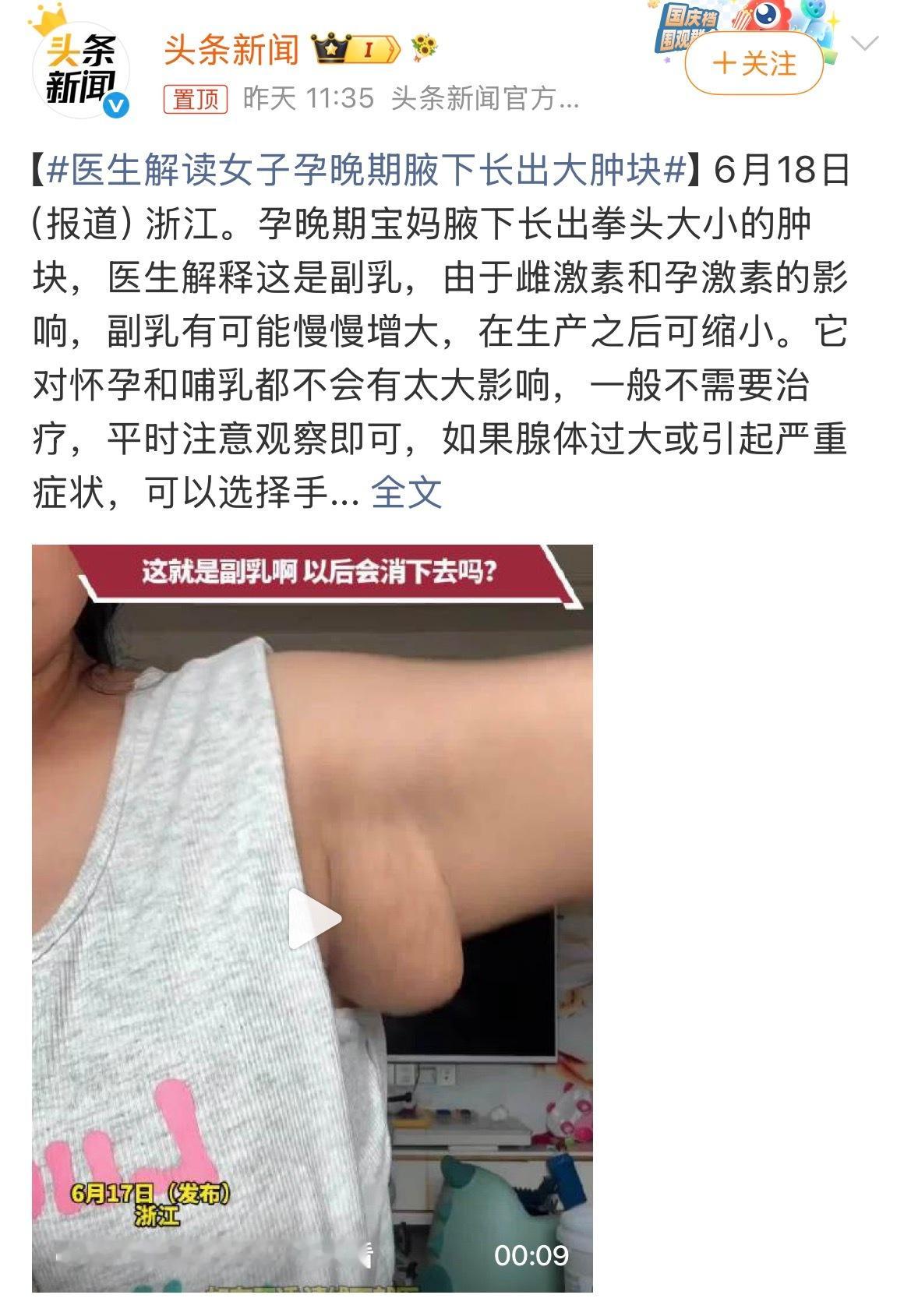 医生解读女子孕晚期腋下长出大肿块原来这才是副乳。以前总是看商家说什么遮副乳，我一