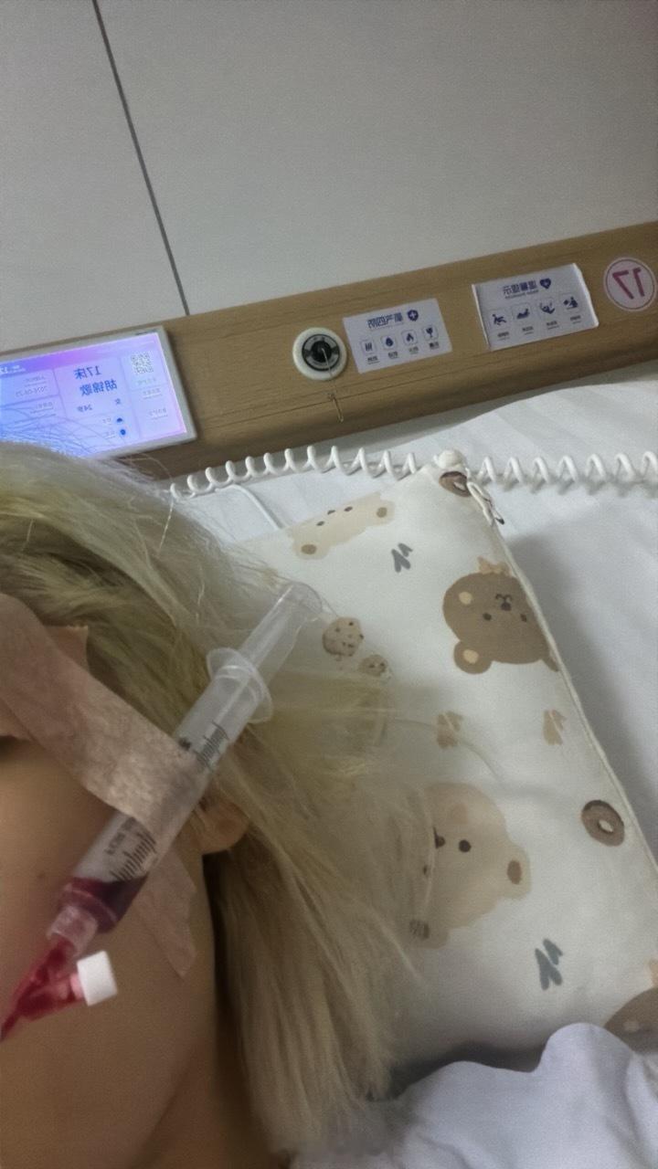 这个管子明天才能拔了 [泪]睡醒一个管子都满了 这会儿是换的新的 ​​​