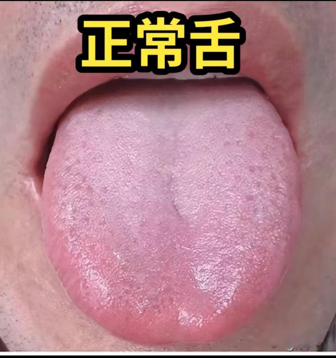 正常舌头应如此，快来对比看看，你的舌头是否达到了健康的标准呢

看了很多不健康的