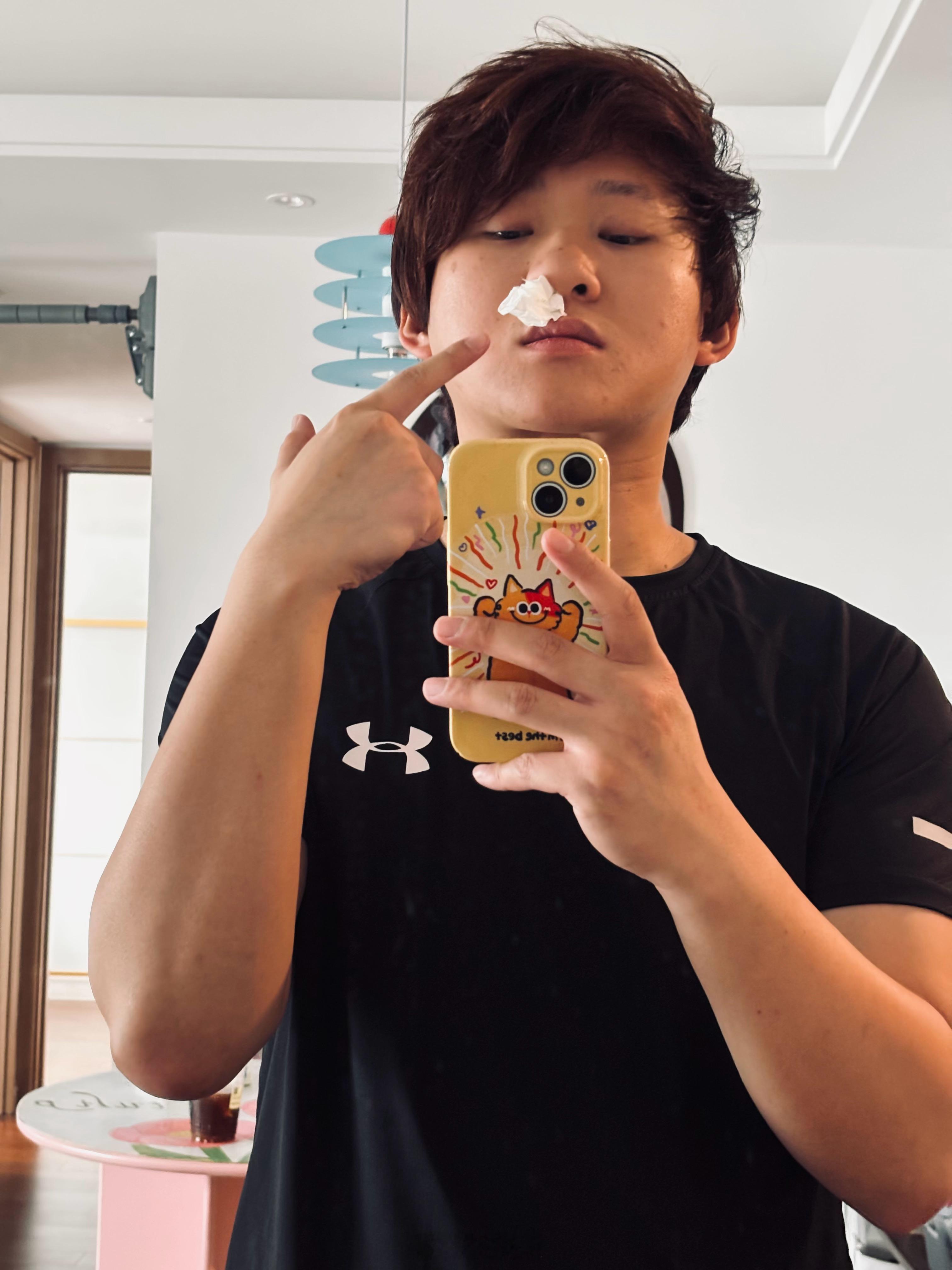 狮头鹅粉肝吃完第二天的后遗症 