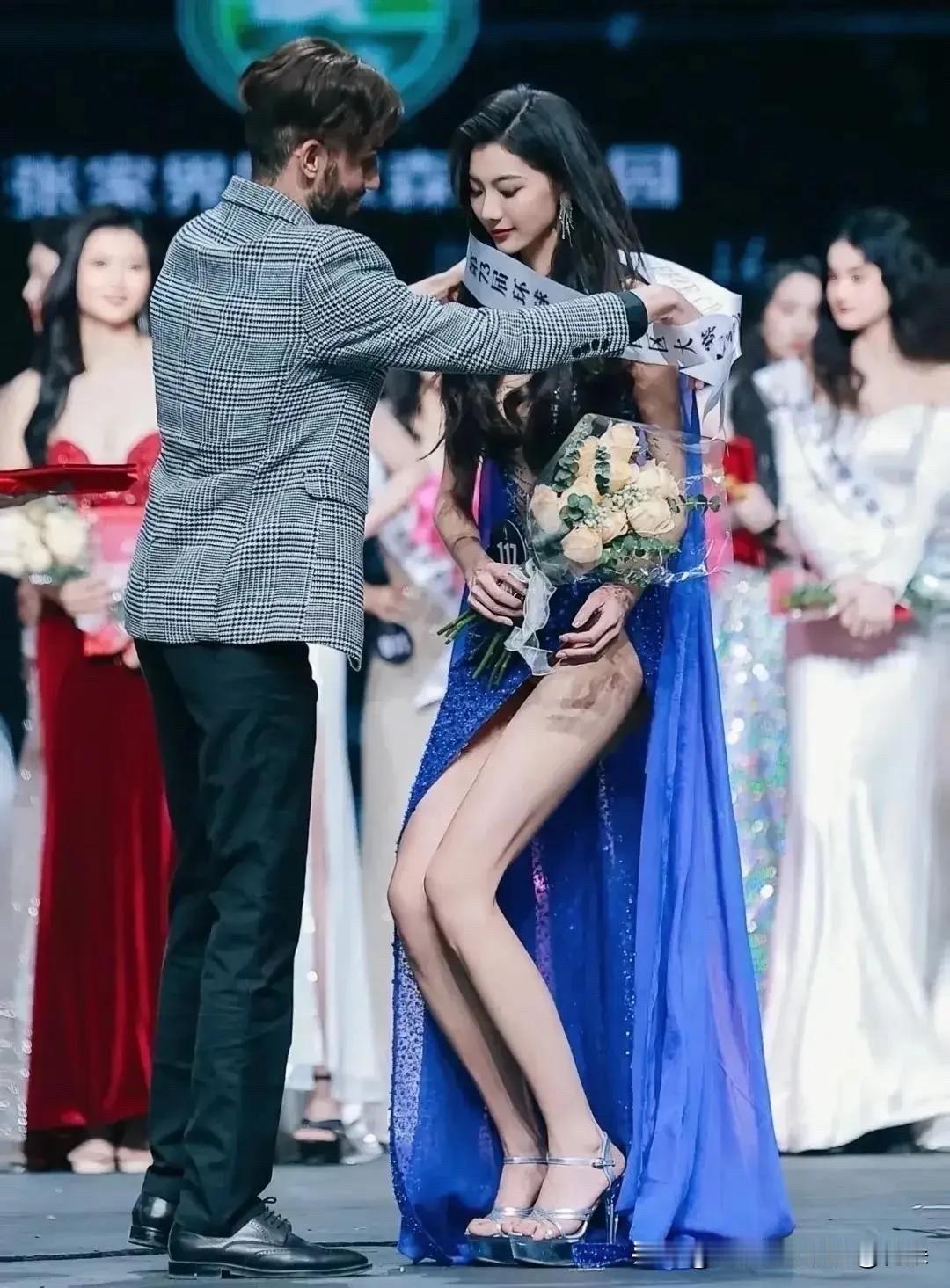 女孩很美，她的腿怎么啦
选美的这个女孩1米78，
又颜值在线，还彬彬有礼
学历还