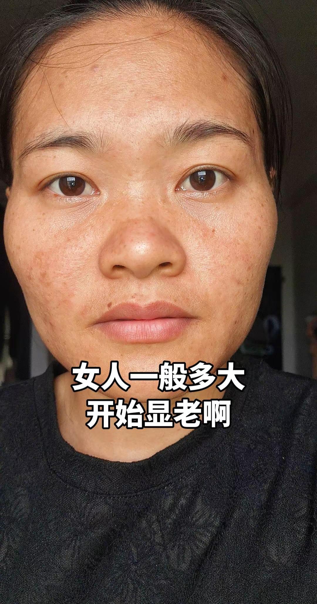 女生一般多大开始显老啊素颜状态下的皮肤 记录下真实的自己 90后