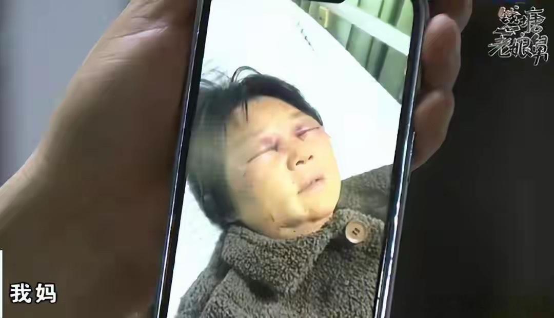 奶奶恋爱不带孙被儿媳打断四根肋骨 丈夫站在妻子这一边：虽然妻子多次动手，但情有可