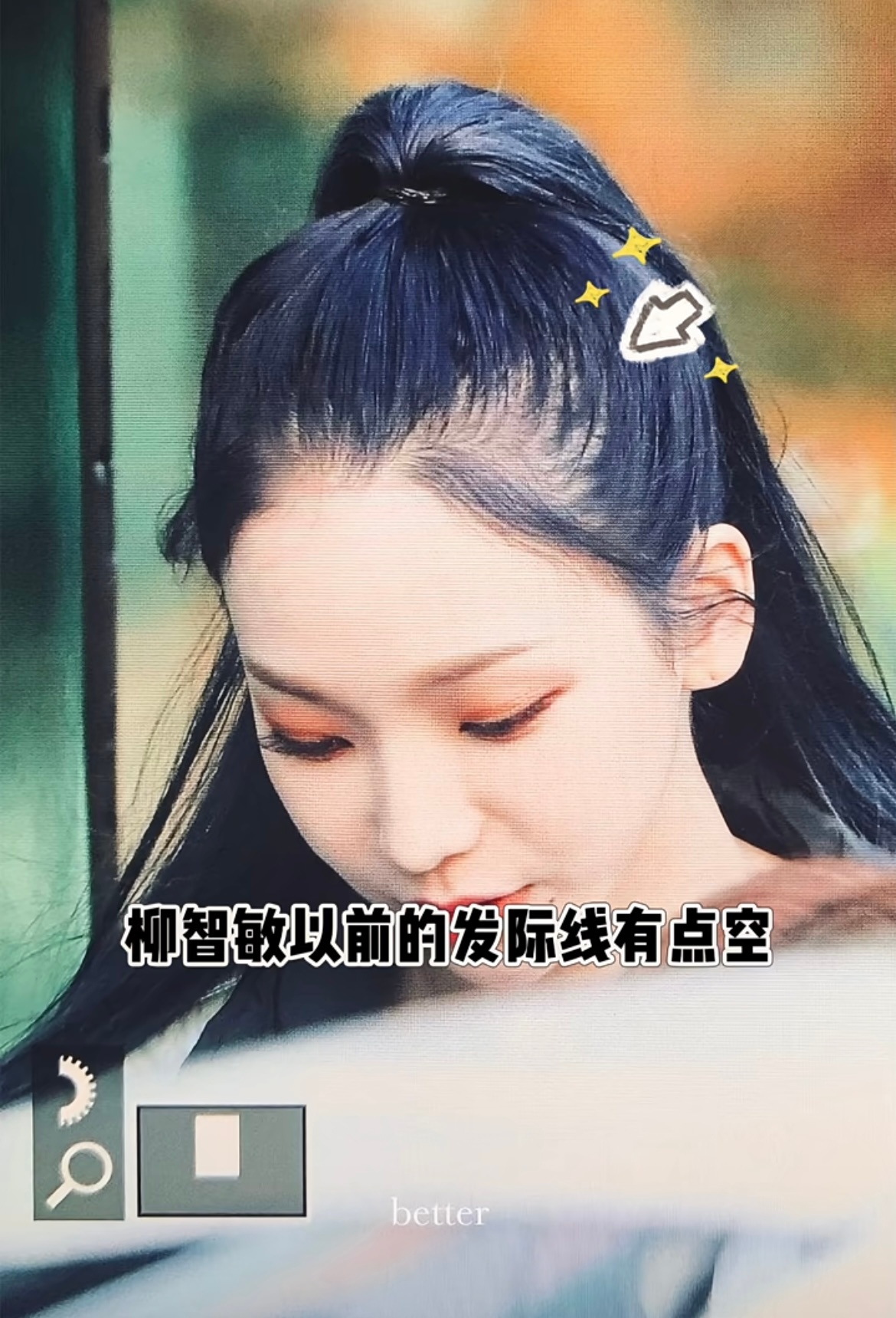 柳智敏 植发前后极致反差