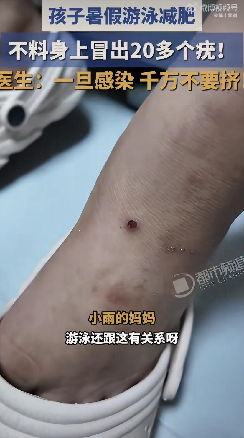 这两天有个事儿挺闹心，河南一个姑娘想趁着暑假游游泳减减肥，结果游了二十来天，体重