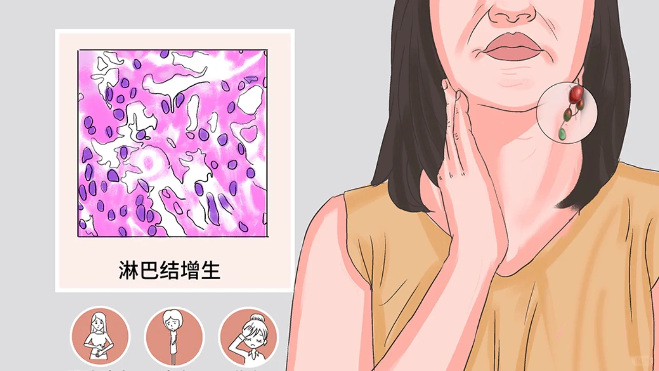 面对“反应性淋巴结”应如何反应？超声来帮忙