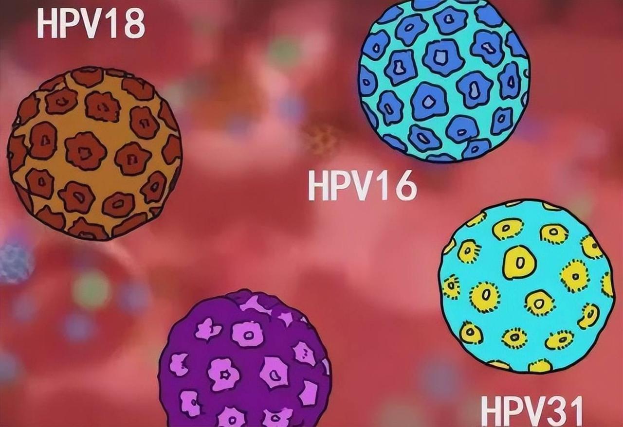 感染了HPV，这2种型号很难治！希望你没有遇到

感染HPV后，很多人最常问的一