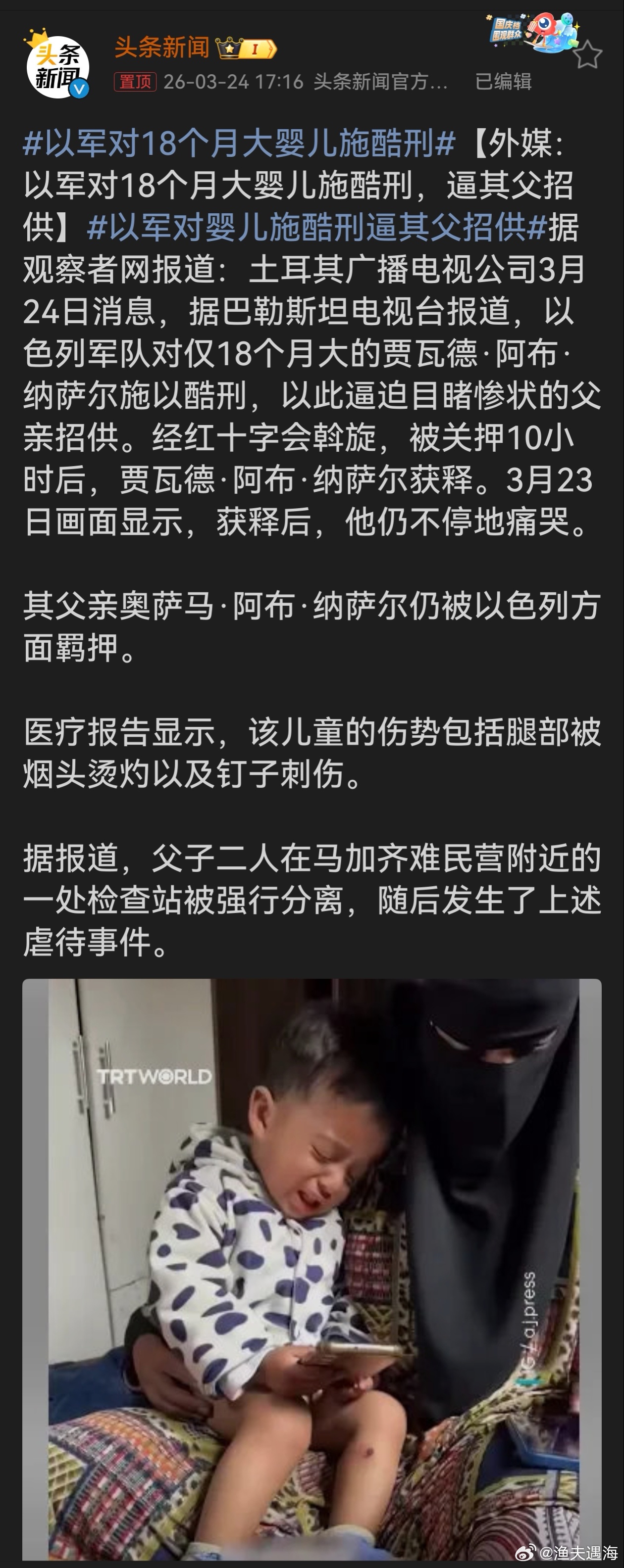 以军对18个月大婴儿施酷刑以色列此举毫无人性，令人发指。对18个月大婴儿施酷刑来