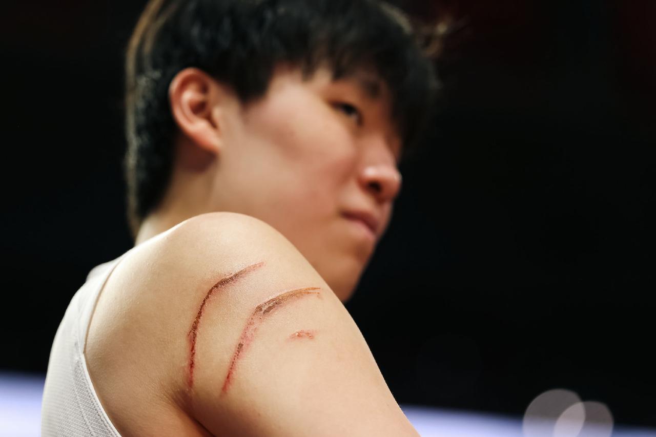 这是少林鹰爪功吗？[白眼]看看这张图片就知道今天杨瀚森所面临的对抗强度有多激烈了