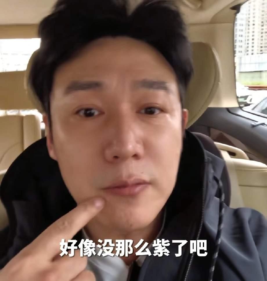 陆毅的体检报告，道出帅哥的“中年危机”！

近期陆毅因网友提醒嘴唇发紫，主动去医