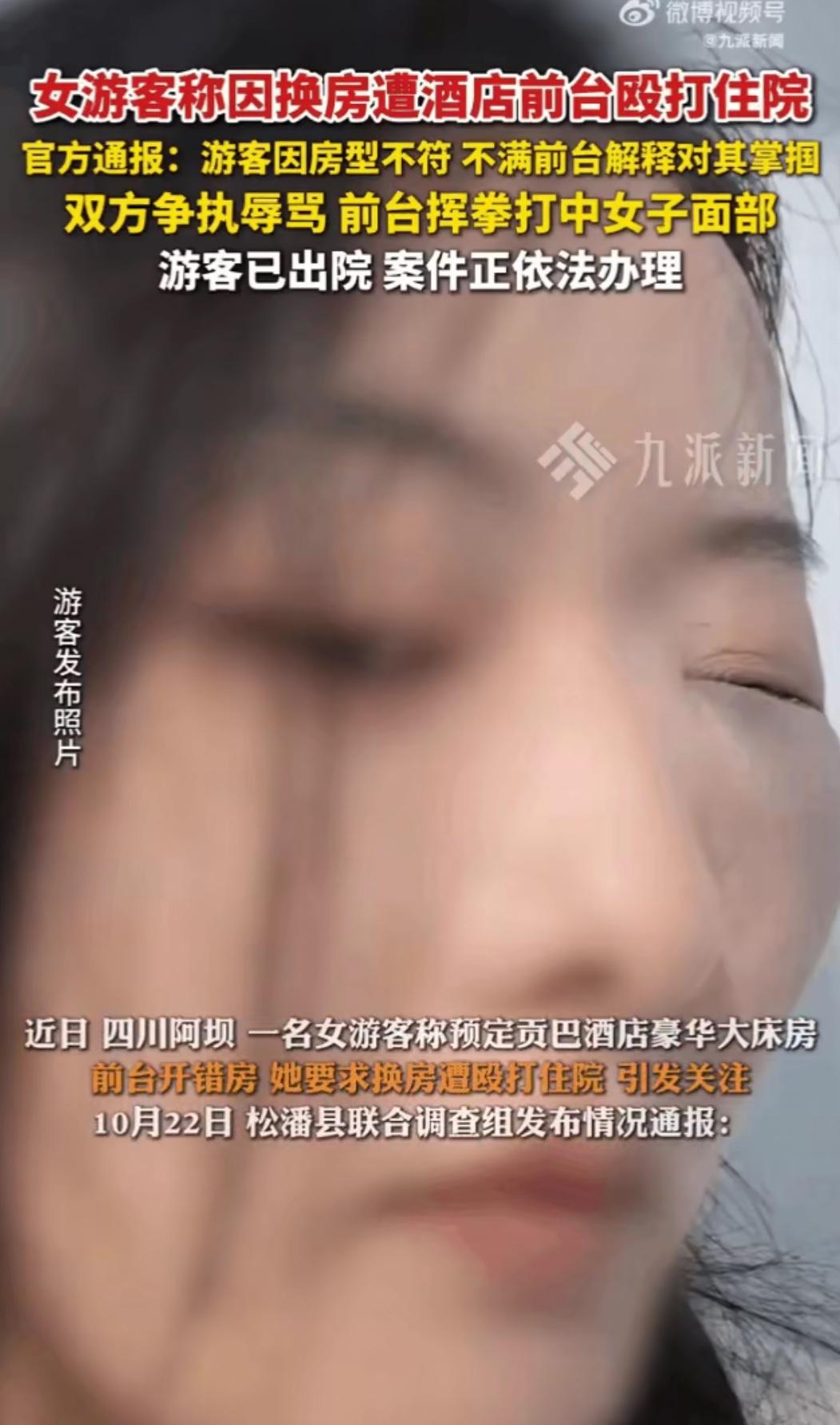 “女子打人被打回一拳，鼻青脸肿结束九寨沟之旅”

出门旅游真是多一事不如少一事