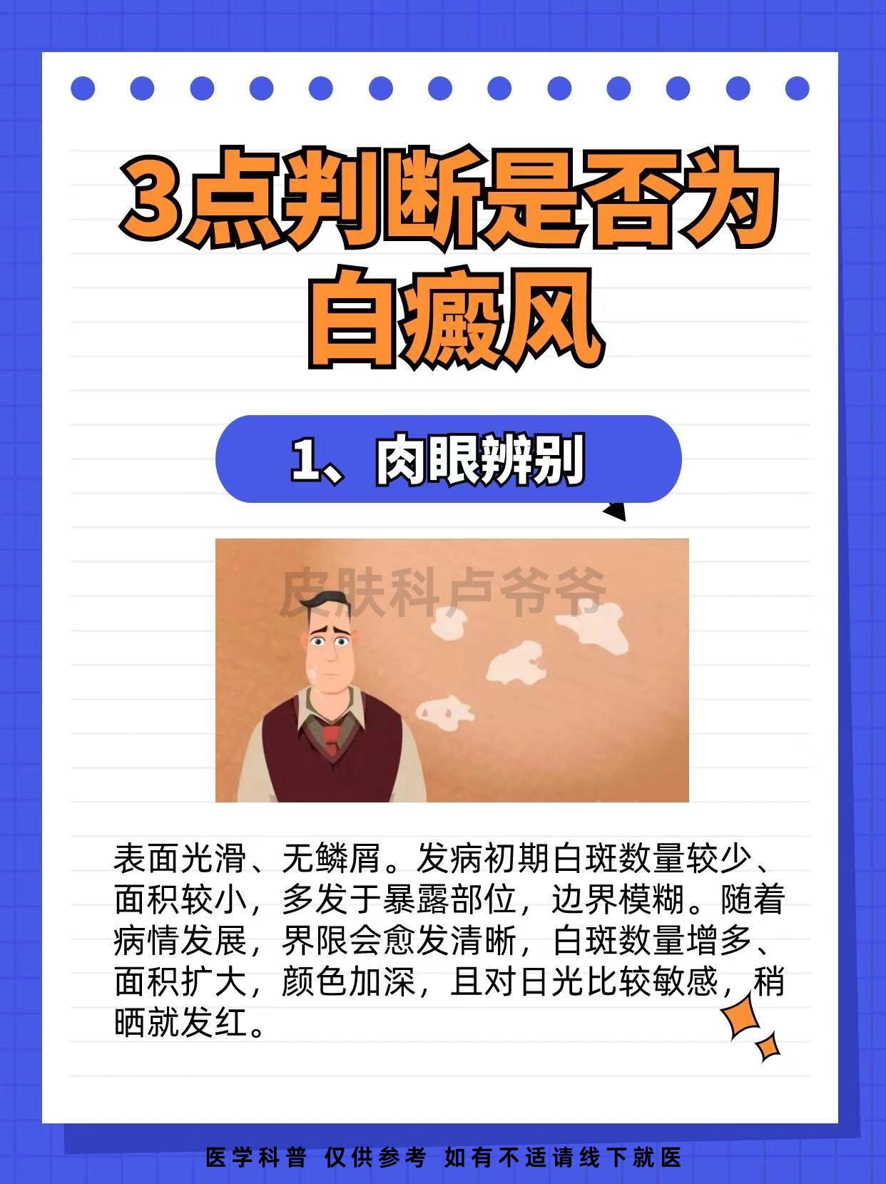 教你三招，判断白癜风