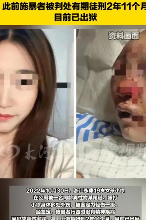 浙江永康，19 岁女子在公厕如厕时，遭同村同龄男子尾随并施暴长达 20 多分钟。