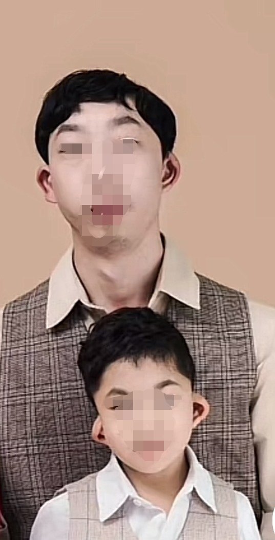 遗传这东西真是无解，一代更比一代差……这耳朵应该可以做矫正吧？太影响颜值和运气了