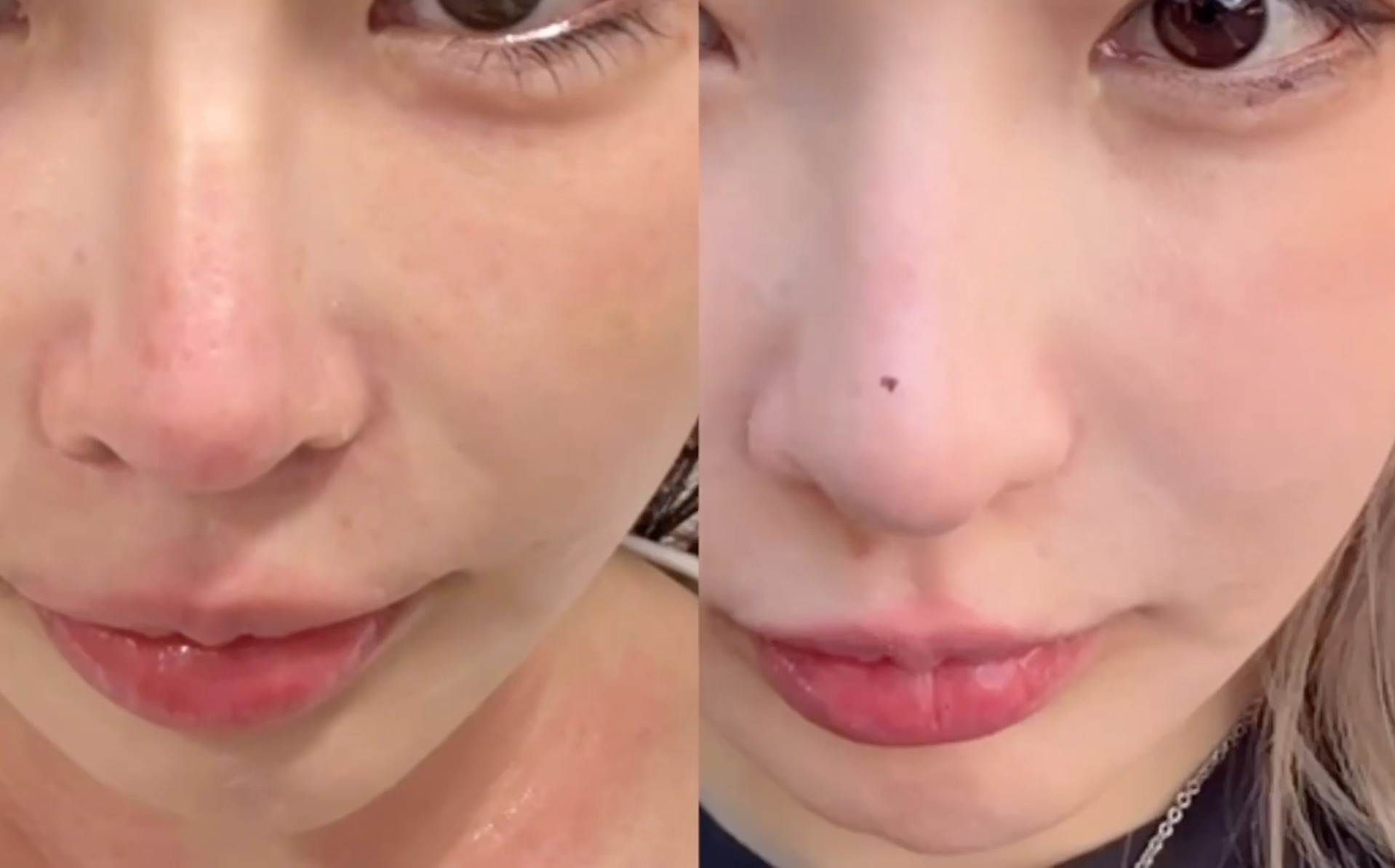 这样看鼻子改变就是润物细无声，单看没觉得do哪儿了，一对比还是少了很多整感，比例