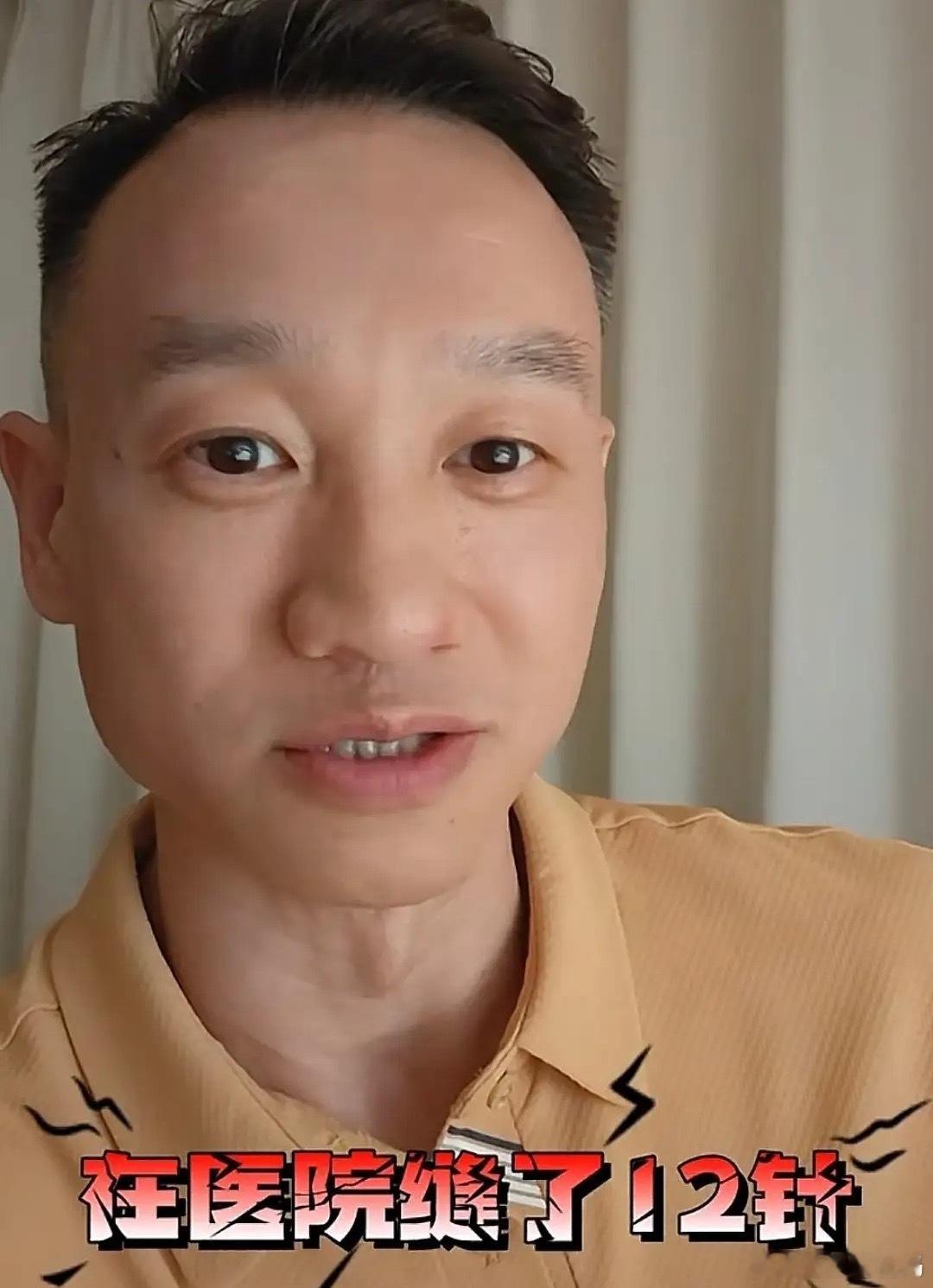 杨威透露儿子刚放暑假就受伤了，杨阳洋打篮球被队友一手肘磕在眼角上，当场流了很多血