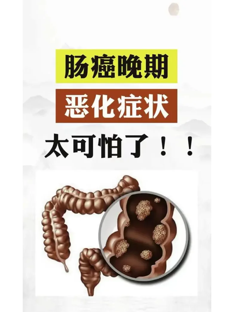 肠癌晚期恶化症状有哪些？