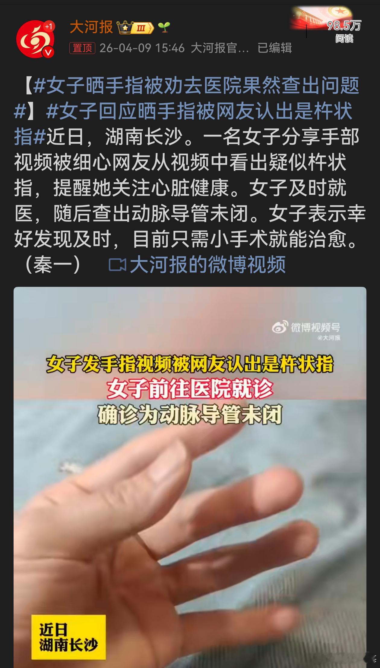 女子晒手指被劝去医院果然查出问题这是一场幸运的“指”间发现。网友的细心提醒与女子