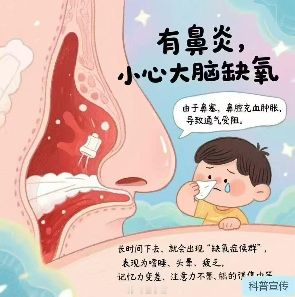 鼻炎 记忆力下降 鼻炎真的会影响记忆力！ 从生理机制来看，鼻炎引发的长期鼻塞会导