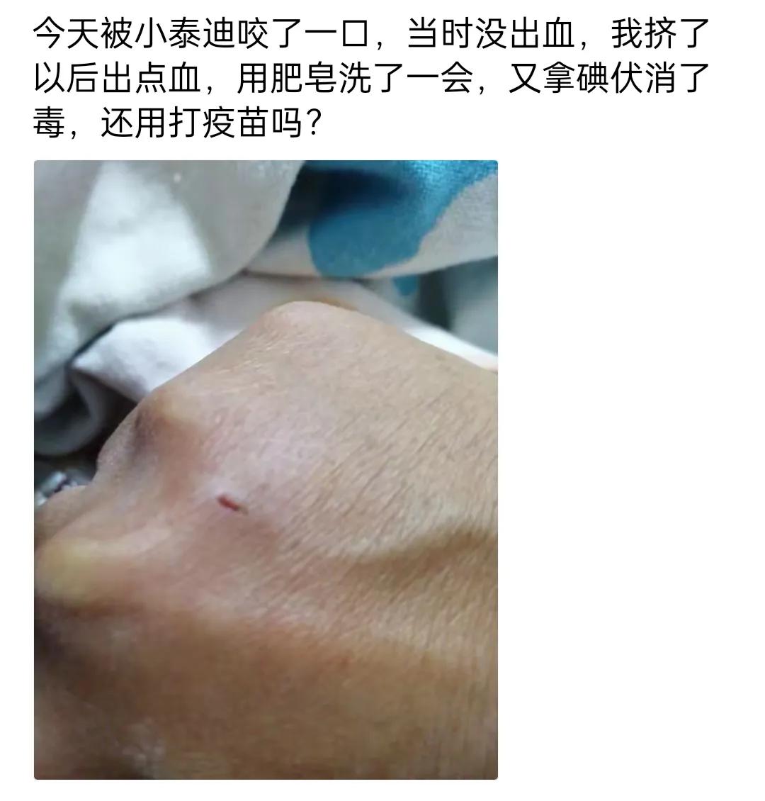 不懂就问：被狗咬了
需要立马打狂犬疫苗吗？

网友神评：必须打，听说狂犬病的潜伏