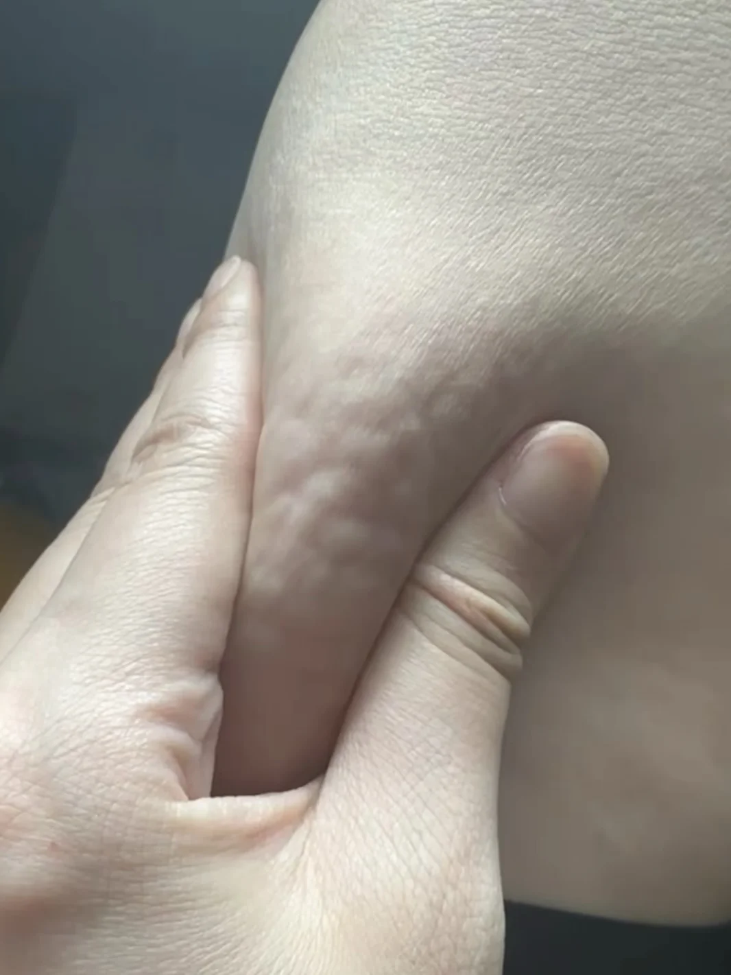如果你的腿也是这德行 去喝它！！