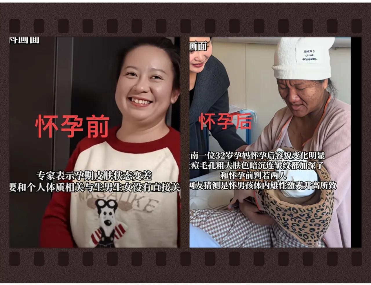 怀孕前后判若两人！云南一位32岁宝妈因生育容貌巨变，看完让人心疼不已。这位宝妈孕