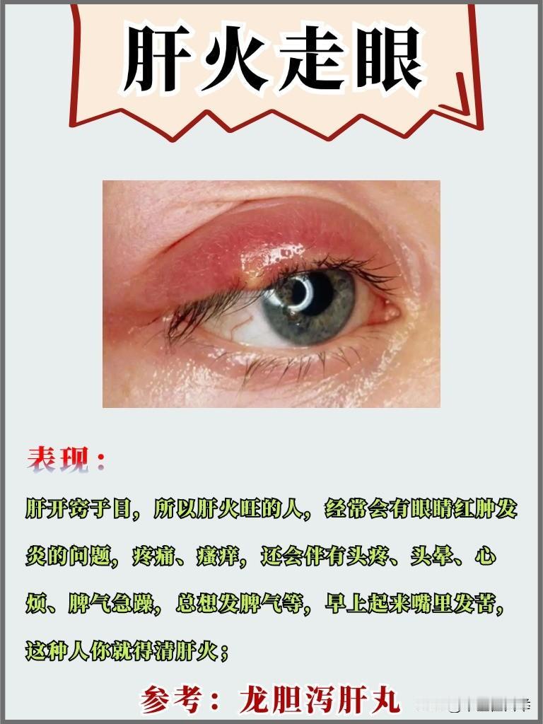 肝火走眼，肾火走耳，心火走舌，肺火走鼻，一盒中成药灭五脏火