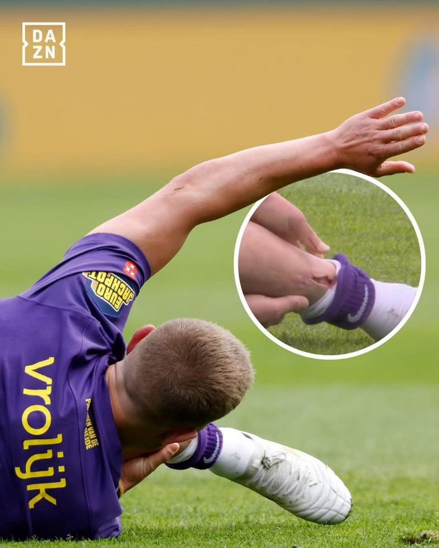 細size嘅護脛（shin pads）近年喺足球界引起咗好大爭議，喺部分聯賽，只