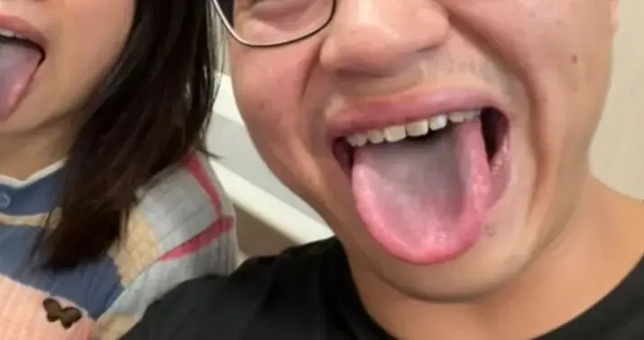 4人火锅店就餐后舌苔发黑，当事人称很闹心，未支付2000多元餐费，火锅店：市监局已取走样本，陪同就医